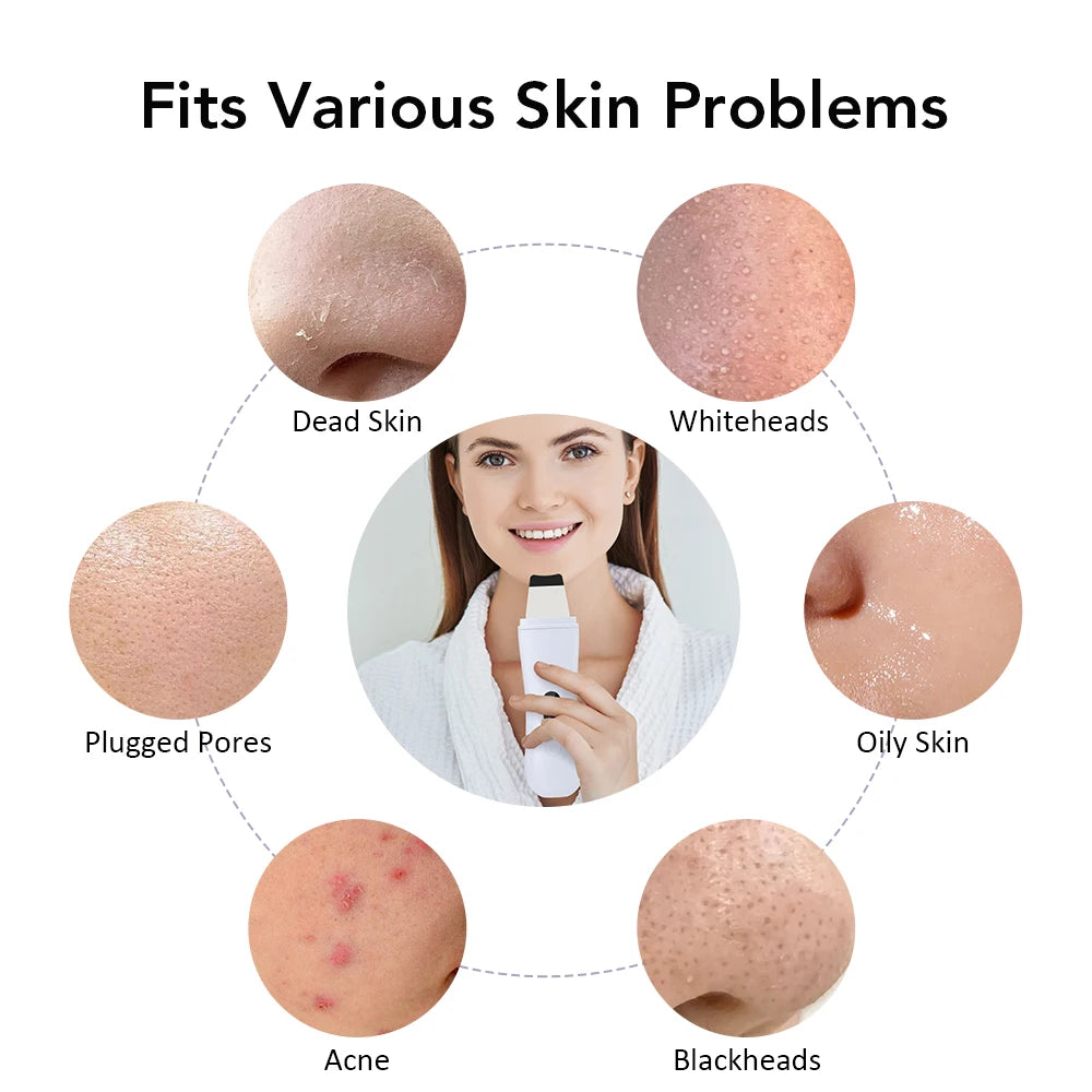 Limpiador Facial Ultrasónico Profesional