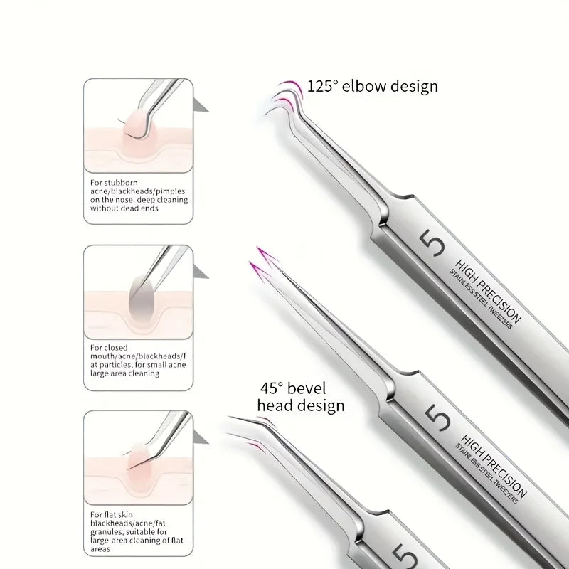 Kit Profesional de Extracción de Imperfecciones (8 Piezas)