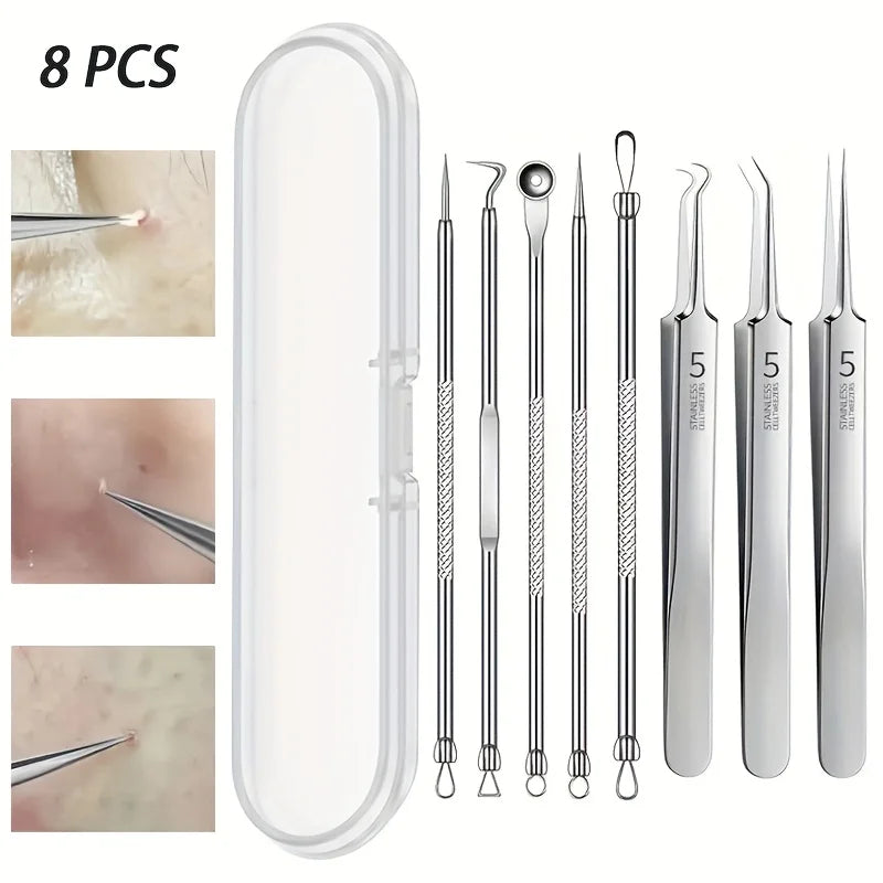 Kit Profesional de Extracción de Imperfecciones (8 Piezas)